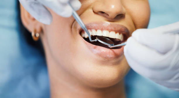 Best Emergency Dentist for Lost Fillings or Crowns in Brandywine Bay, NC